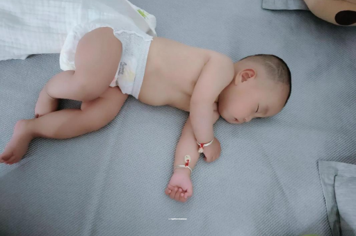 三沙六个月宝宝眼睛散光